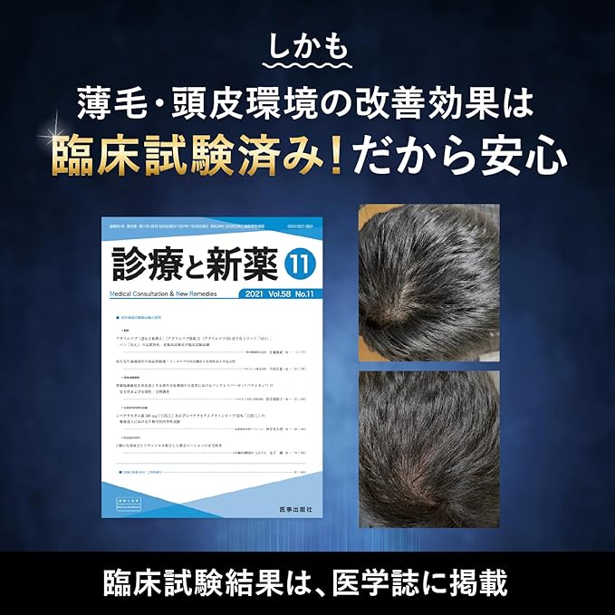 REDEN Medicated Hair Growth Agent 1 Month Work, Quasi-Drug, Lidencil, Men's, Unisex, Scalp Care, Hair Growth Tonic