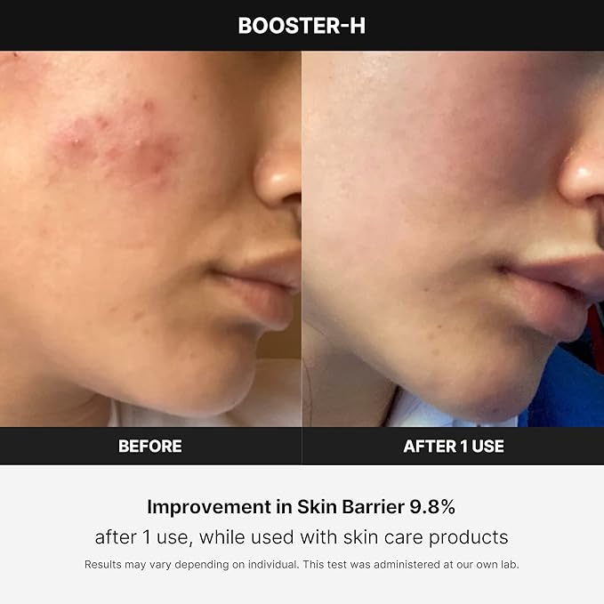 Medicube Age-R Booster-H