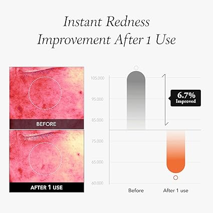 APRILSKIN Carotene IPMP™ Blemish Serum Pack Pad