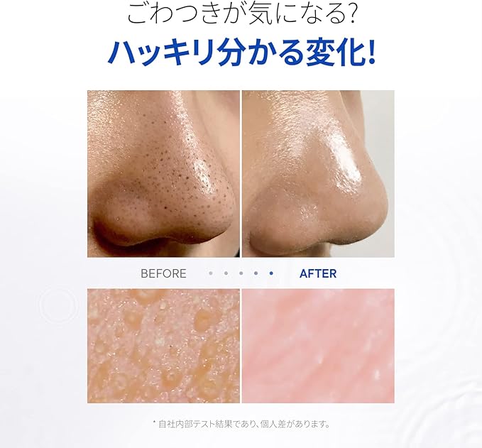 One Day's You P.Z. SSOC No More Blackhead Removal Pore Clean Duo Planning Set, Skin Care, Sebum Care