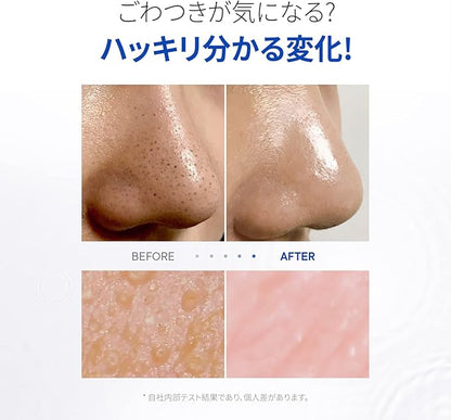 One Day's You P.Z. SSOC No More Blackhead Removal Pore Clean Duo Planning Set, Skin Care, Sebum Care